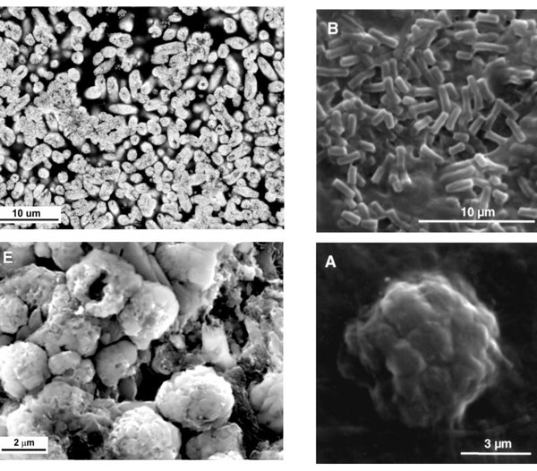 Joonis 3. Vasakul on toodud elektronmikroskoobi pilt arvatavatest metanotroofsetest bakterifossiilidest ja paremal on pilt tänapäevastest analoogidest (parempoolne pilt: Knittel 2005).