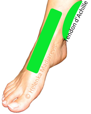 pied-dorsal-zone-lymphatique-tendon-Achille