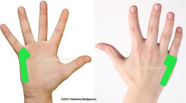 photo, une main, coté palmaire et dorsal, partie charnu dans le prolongement du petit doigt
