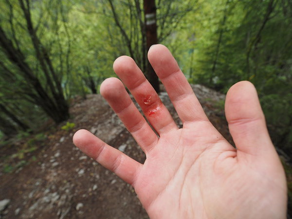 siidikäpp pärast köievedu