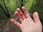 my hand after pulling the rope