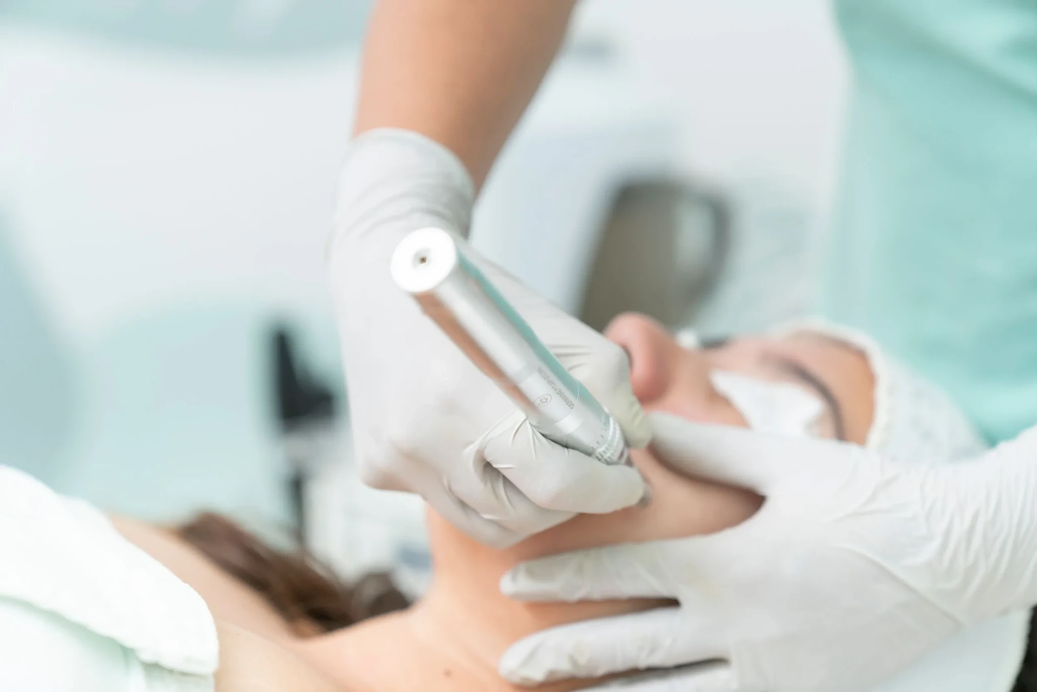 mikronõelumine ehk microneedling näohoolduses