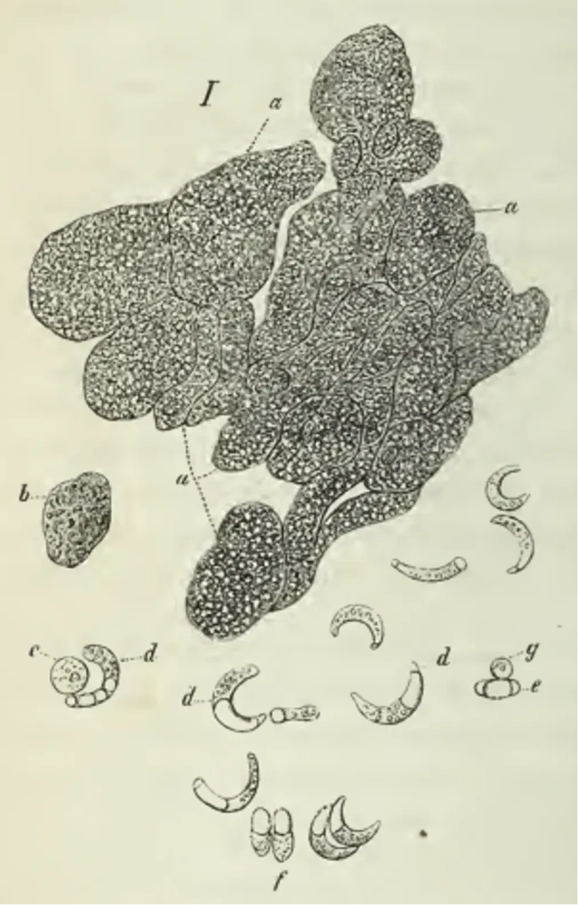 Abbildung aus der Publikation: Eigenartige Schläuche in den Muskeln einer Hausmaus Verhandlungen der Schweizer Naturforschenden Gesellschaft, 1842