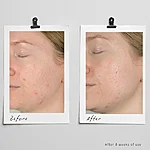 Skinome azeretinal concentrate naokontsentraat 30 ml 1